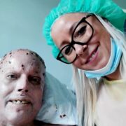 POMÓŻMY MIRKOWI W WALCE O ŻYCIE I PRZYSZŁOŚĆ