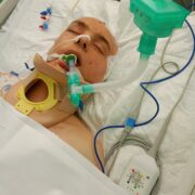 Jedna chwila zabrała wszystko – pomóżmy Kacprowi odzyskać przyszłość