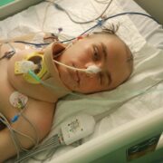 Jedna chwila zabrała wszystko – pomóżmy Kacprowi odzyskać przyszłość