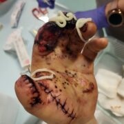 Jedna sekunda, która zgasiła światło. Pomóżmy Pawłowi poskładać jego życie na nowo!