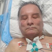 Leczenie i rehabilitacja Pana Krzysztofa po wypadku w pracy